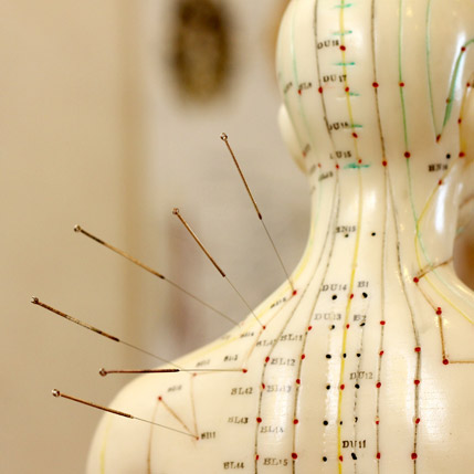 acupuncture